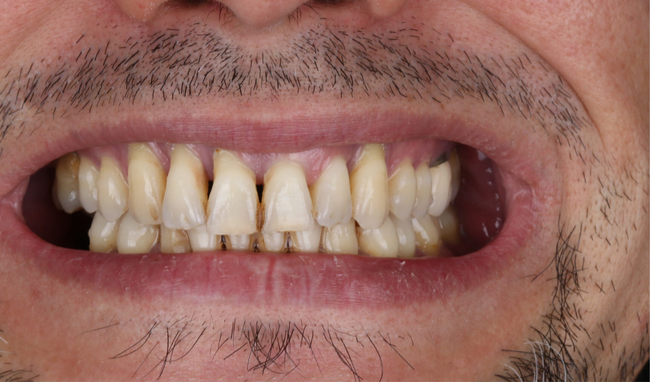 Testing Before and After 2 before image
