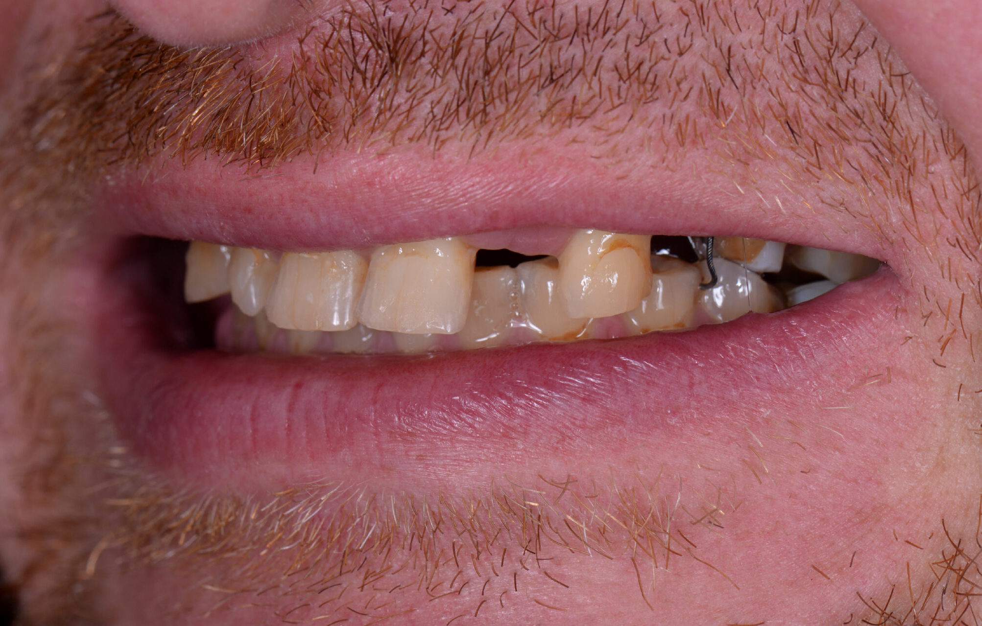 Testing Before and After 4 before image