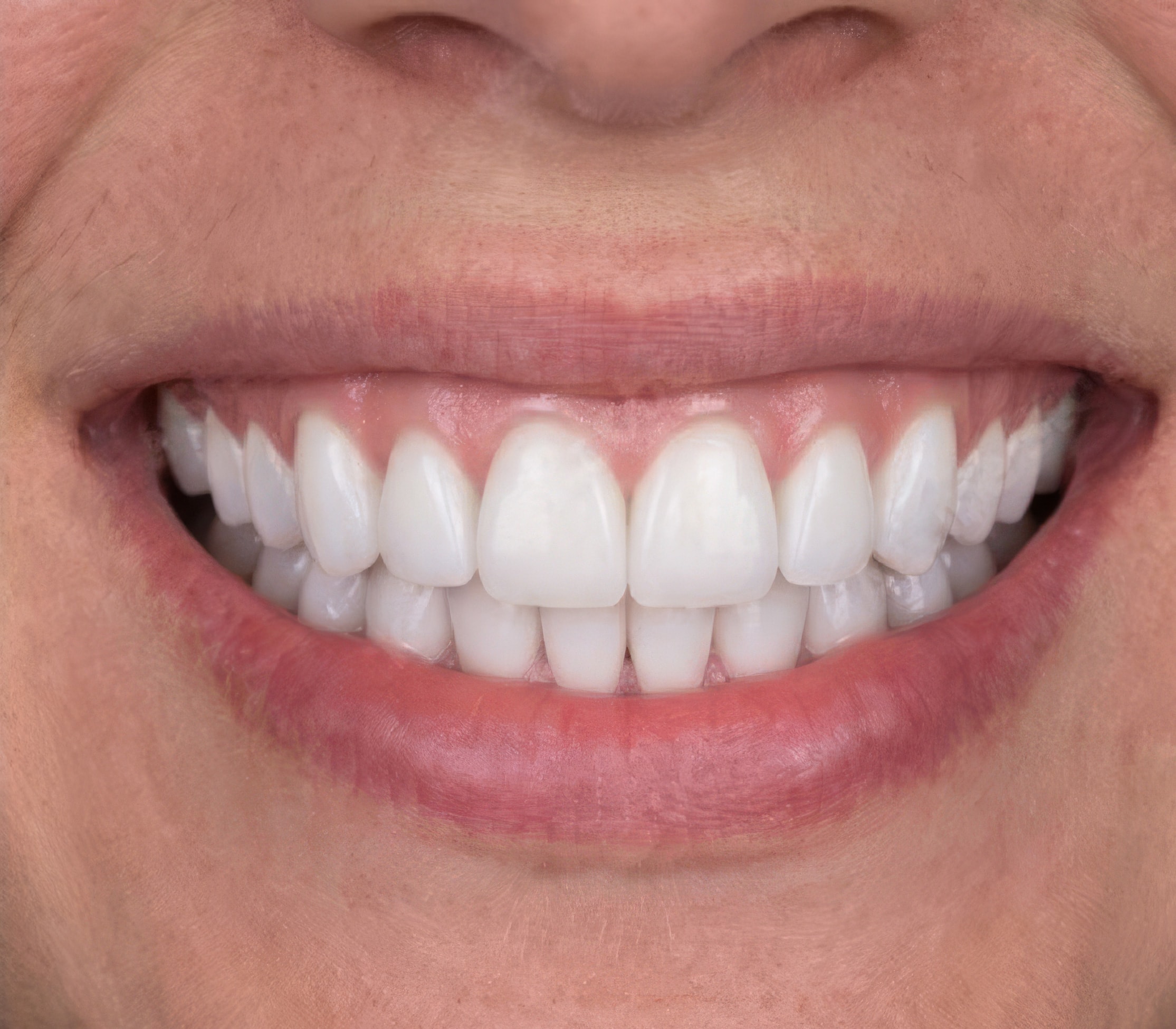 Testing Before and After after image